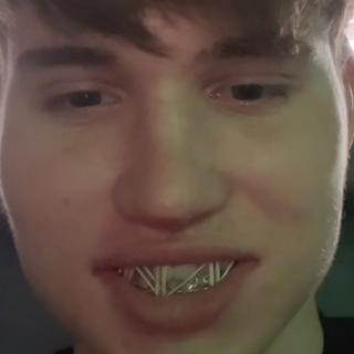 MERSACE
